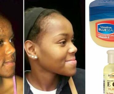 VASELINE WITH VITAMIN E OIL WILL CHANGE YOUR SKIN OVERNIGHT