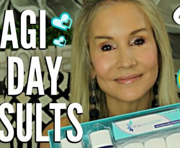 OBAGI NU-DERM 30 DAY RESULTS PICS