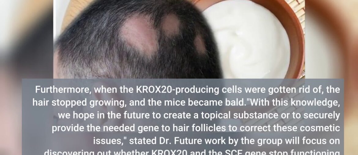 Examine This Report on Hair loss cure - LloydsPharmacy Online Doctor UK