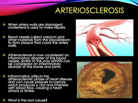 Improve Your Cardiovascular Health by Dr  Sheryl, ND