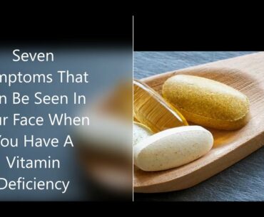 Seven  Symptoms Seen In Your Face When You Are Deficient In Vitamins
