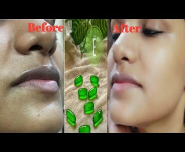 Vitamin E Oil Skin Treatment | Get Spotless and Glowing Skin in Just Two Weeks | Swati's vlog |