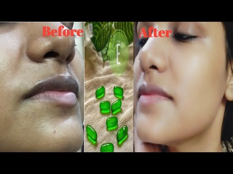 Vitamin E Oil Skin Treatment | Get Spotless and Glowing Skin in Just Two Weeks | Swati's vlog |