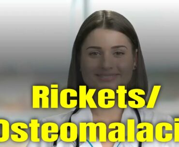 What is Rickets and Osteomalacia Symptoms Causes and Treatment