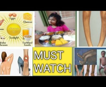 #vitamind | why VITAMIN D is so important.. how does it save us from #coronavirus... MUST WATCH