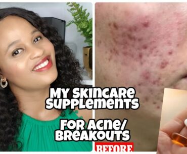 MY SKINCARE SUPPLEMENTS ROUTINE  FOR GLOWY SKIN/2020