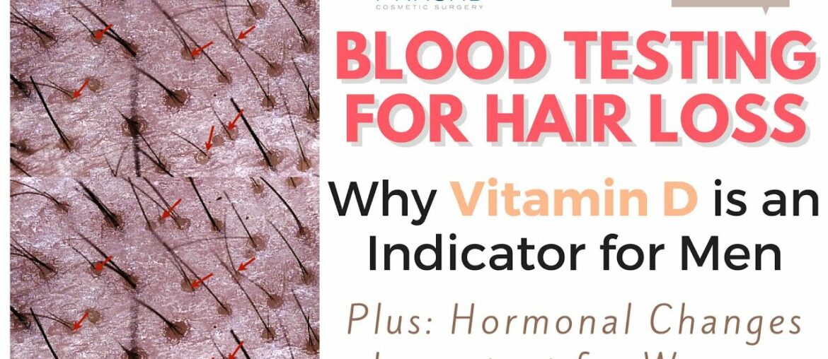 Testing for Hair Loss - Importance of Vitamin D, and Why Genetics are Major Cause of Hair Loss