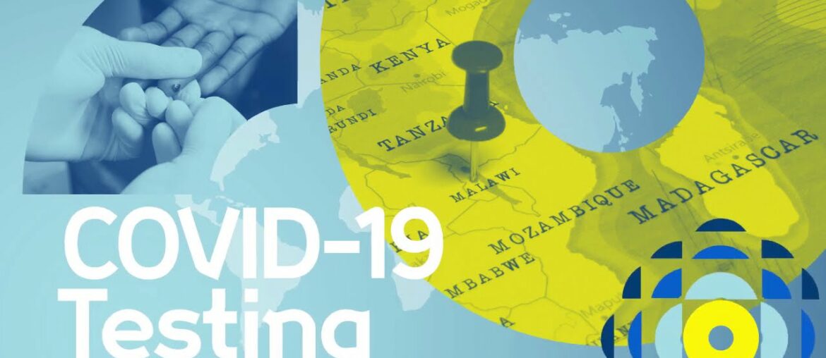 COVID-19 tests: understanding the immune response to coronavirus