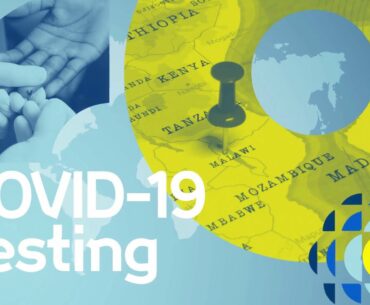 COVID-19 tests: understanding the immune response to coronavirus