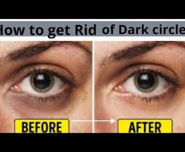 Dark circles under eyes remedy||Remove dark circles permanently||scarlet's beauty||