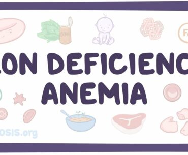 Iron deficiency anemia - causes, symptoms, diagnosis, treatment, pathology