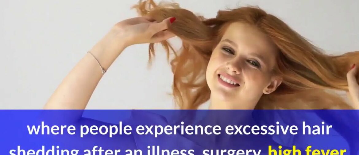 why covid 19 can trigger hair loss in survivors and those who were never sick 1