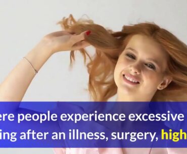 why covid 19 can trigger hair loss in survivors and those who were never sick 1