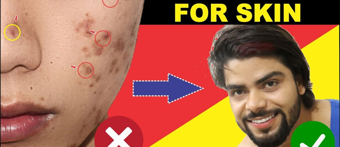 HOW TO IMPROVE YOUR SKIN QUALITY ( AS IT IS Vitamin C )