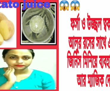 Homemade Potato Face Cream For Skin Whitening and Lightening ||DIYcream||#Natural beauty with tithi