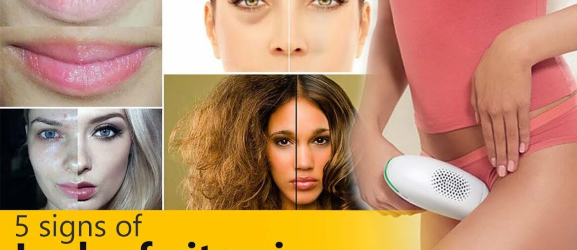 5 signs of lack of vitamins - Seekers Zone