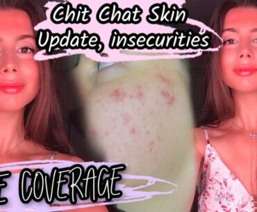 MY NO FOUNDATION MAKEUP ROUTINE || Chit Chat skin issues, thoughts on accutane, confidence