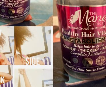 Mane Choice Hair Vitamins
