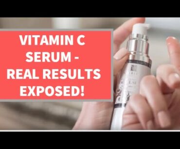 VOIBELLA VITAMIN C FACIAL SERUM - Uses, Benefits & Before and After Customer Results