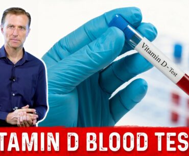 Vitamin D Testing Challenges