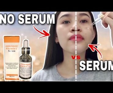 Jadole Naturals Vitamin C Serum Honest Review | Anti-Oxidant | Amazon #SkinCare #VitaminC #Natural