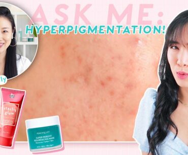 How to Brighten Dark Spots, Acne Marks & Hyperpigmentation ft. @Peach & Lily