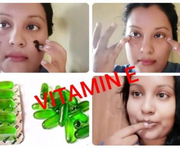 TOP 5  USES OF VITAMIN-E CAPSULES | Vitamin-E Oil Benefits