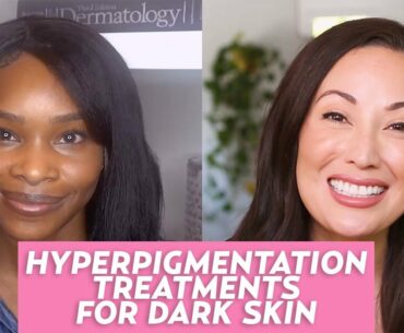 Hyperpigmentation in Dark Skin Tones: A Dermatologist Shares Tips & Treatments!