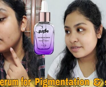 My thoughts about Purple skin repair serum with vitamin e & c . Best for pigmentation & blemishes??