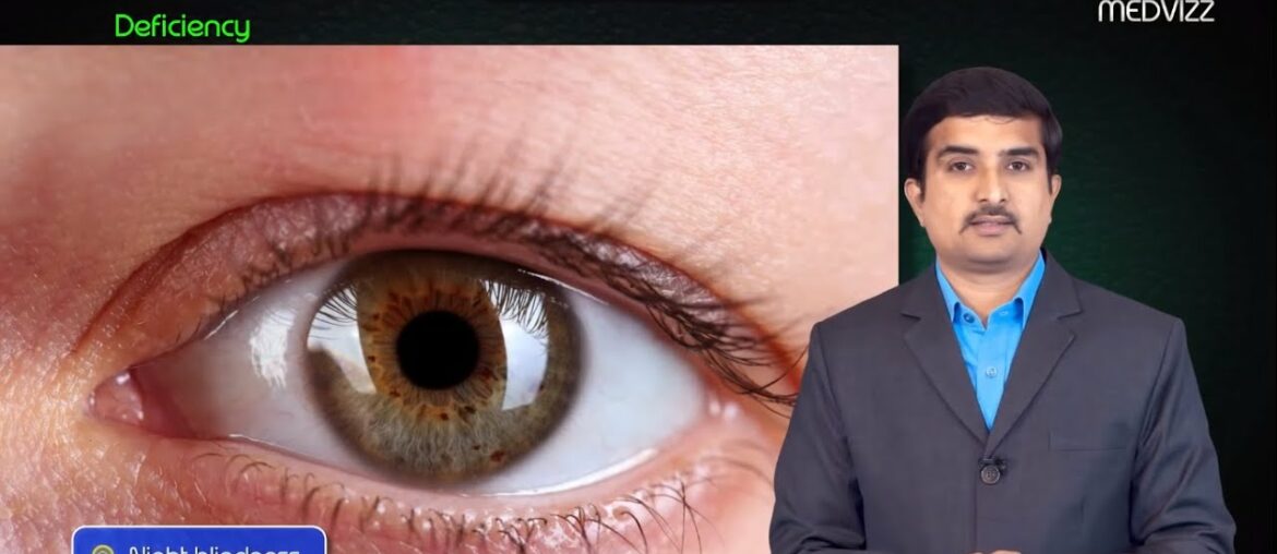 Vitamin A Chemistry , source , Metabolism , Deficiency - Usmle step 1 Biochemistry Dr Bhanu prakash