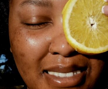 GET RID DARK SCARS WITH VITAMIN C