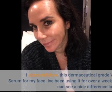 Energize Vitamin C Serum for Face & Eyes - Clinical Strength Collagen Booster with Triple Vitam...