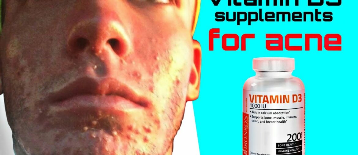 Vitamin D Supplements for Acne - Taking Vitamin D for Acne - Natural Skincare