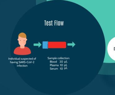 Immune diagnosis COVID19
