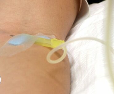 Why is IV Vitamin Therapy or Intravenous Therapy So Beneficial