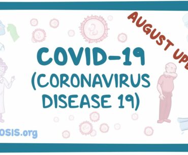 COVID-19 (Coronavirus Disease 19) August Update- causes, symptoms, diagnosis, treatment, pathology