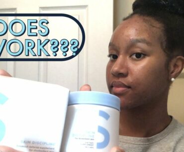 Honest One Month Skin Discipline Review | Zitsticka Vitamin Supplement for Acne | Before and After