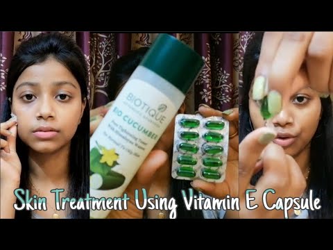 Skin Treatment Using "Vitamin E" Capsule || Night Skincare With Vitamin E || Saheli Das ||