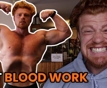 My Blood Test Results Before Using Steroids... Again.