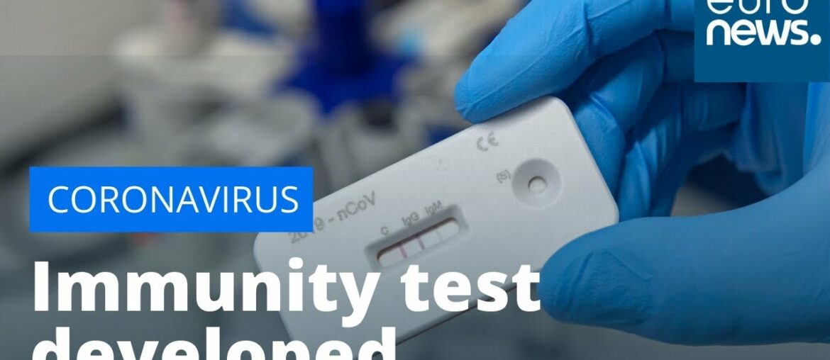 French company creates 15-minutes test for COVID-19 immunities