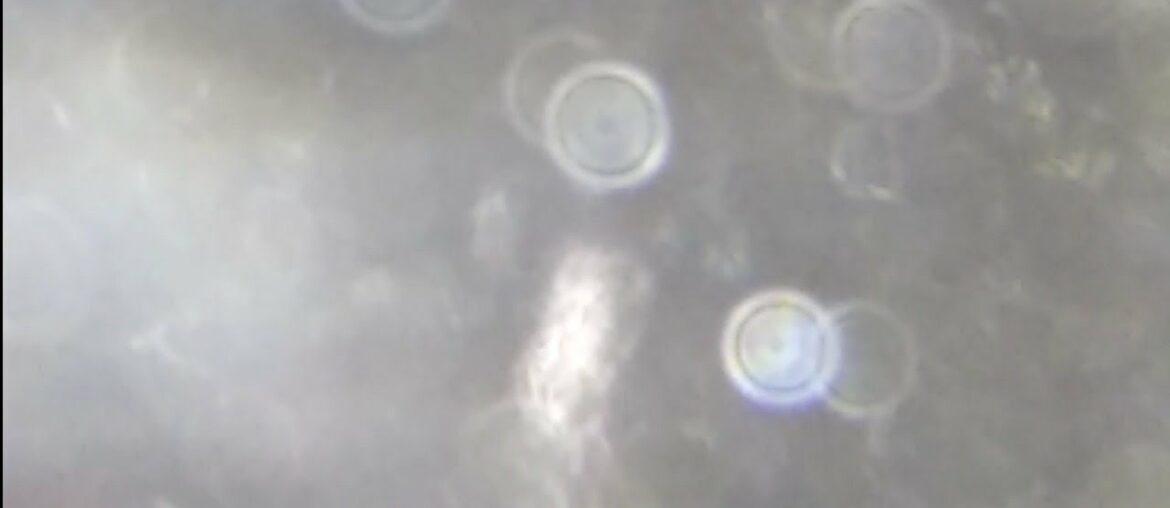 Video The Cure! (5676977) P.1 Of two. READ THE DESCRIPTION!