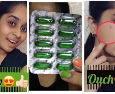 Benefits and side effects of using vitamin E capsules.