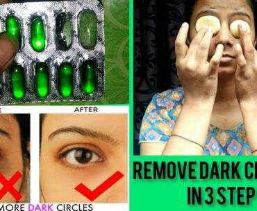 Remove Dark circles in 3 step. Style & beauty tips by archu