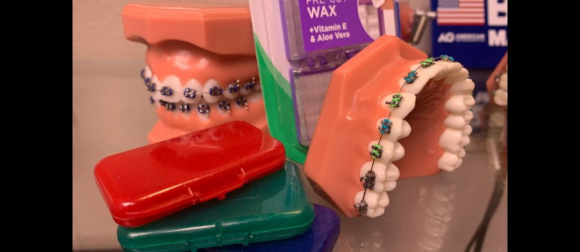 COVID19 How to Use Orthodontic Wax