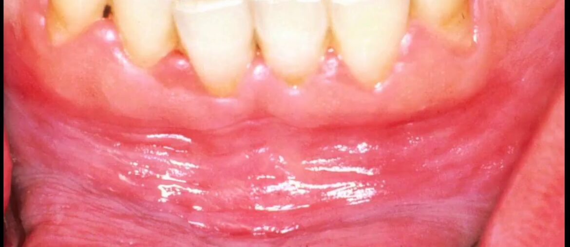 Getting The Health - Dietary supplements, Vitamins, Canker sore - Pinterest To Work