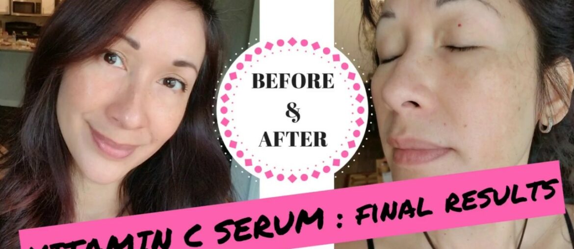 Vitamin C Serum | FINAL RESULTS | SEOUL CEUTICALS | YOUTUBE