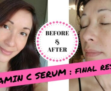 Vitamin C Serum | FINAL RESULTS | SEOUL CEUTICALS | YOUTUBE