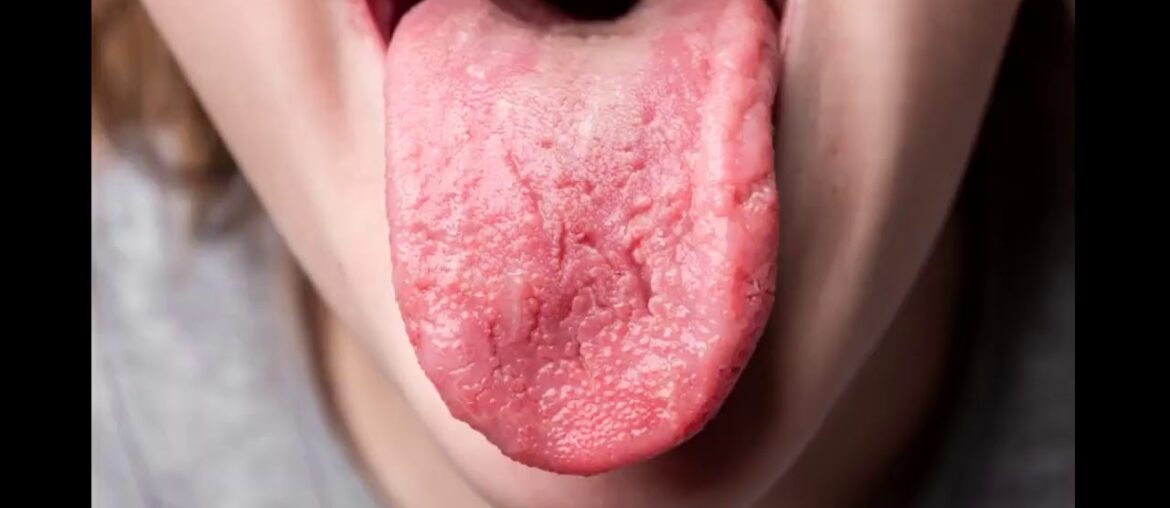 Health - Dietary supplements, Vitamins, Canker sore - Pinterest Can Be Fun For Everyone