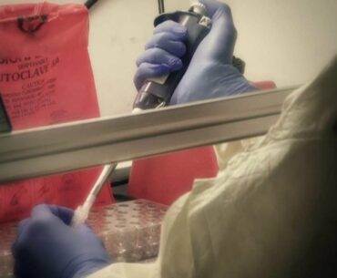 When should you get a COVID-19 antibody test?