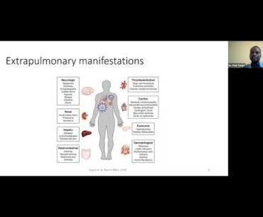 COVID19 CASE MANAGEMENT